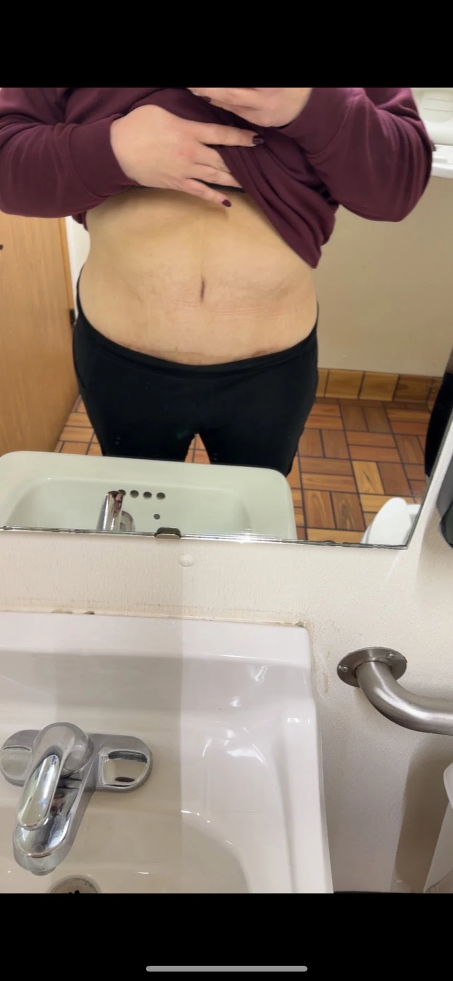 Brink Physiques client progress photo, continued
